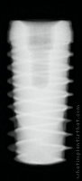 Radiograph of Dynamic