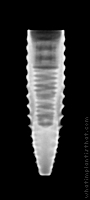 Radiograph of INNO Submerged Narrow