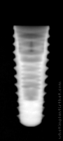 Radiograph of INNO Submerged