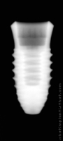 Radiograph of INNO Internal