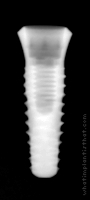 Radiograph of INNO Internal