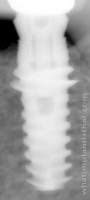 Radiograph of Saturn