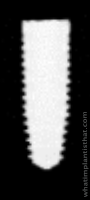 Radiograph of Neodent Zirconia