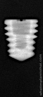 Radiograph of Titamax WS Medular