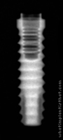 Radiograph of Bio-Lok Micro-Lok