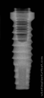 Radiograph of Bio-Lok Micro-Lok