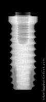 Radiograph of Bio-Lok Micro-Lok