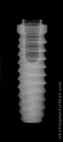 Radiograph of Bio-Lok Micro-Lok