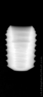 Radiograph of INNO Submerged