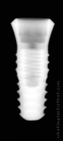 Radiograph of INNO Internal