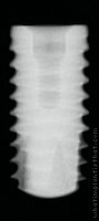 Radiograph of Shark