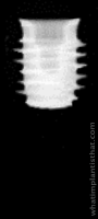 Radiograph of Neodent Helix Short