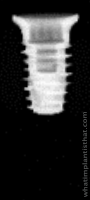 Radiograph of Neodent Helix Short