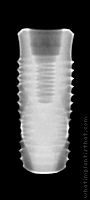 Radiograph of INNO Internal