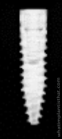 Radiograph of Bone Level Tapered SC