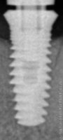 Radiograph of Dicoa