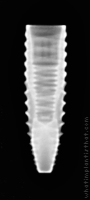 Radiograph of INNO Submerged Narrow