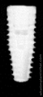 Radiograph of Bone Level Tapered RC