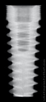 Radiograph of Shark