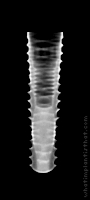 Radiograph of INNO Submerged