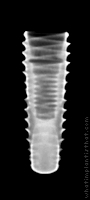 Radiograph of INNO Submerged
