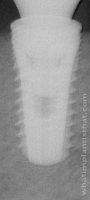 Radiograph of Submerged