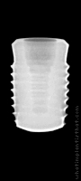 Radiograph of INNO Internal