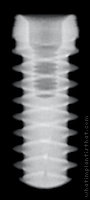 Radiograph of Dynamic