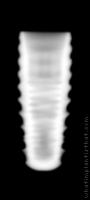 Radiograph of INNO Submerged Narrow