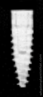 Radiograph of Bone Level Tapered SC