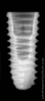 Radiograph of ET III