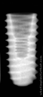 Radiograph of ET III