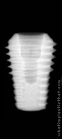 Radiograph of ET III Ultra-Wide