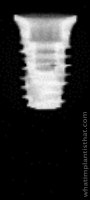 Radiograph of Neodent Helix Short