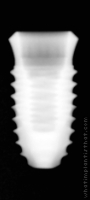Radiograph of INNO Internal