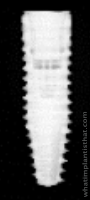 Radiograph of Bone Level Tapered RC
