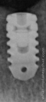 Radiograph of Rex BL 2.9