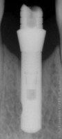 Radiograph of Biolife I