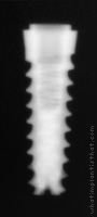 Radiograph of Hati
