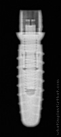Radiograph of iSy