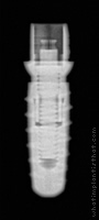 Radiograph of iSy