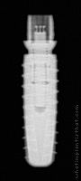 Radiograph of iSy