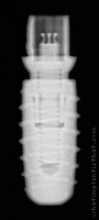 Radiograph of iSy