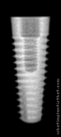 Radiograph of Tapered
