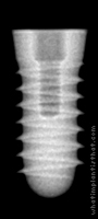 Radiograph of Tixos