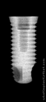 Radiograph of Implus Cylinder