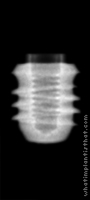 Radiograph of Tixos Short
