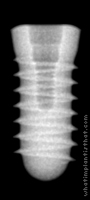 Radiograph of Tixos MC