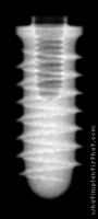 Radiograph of Tixos Cylinder