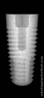 Radiograph of Tapered